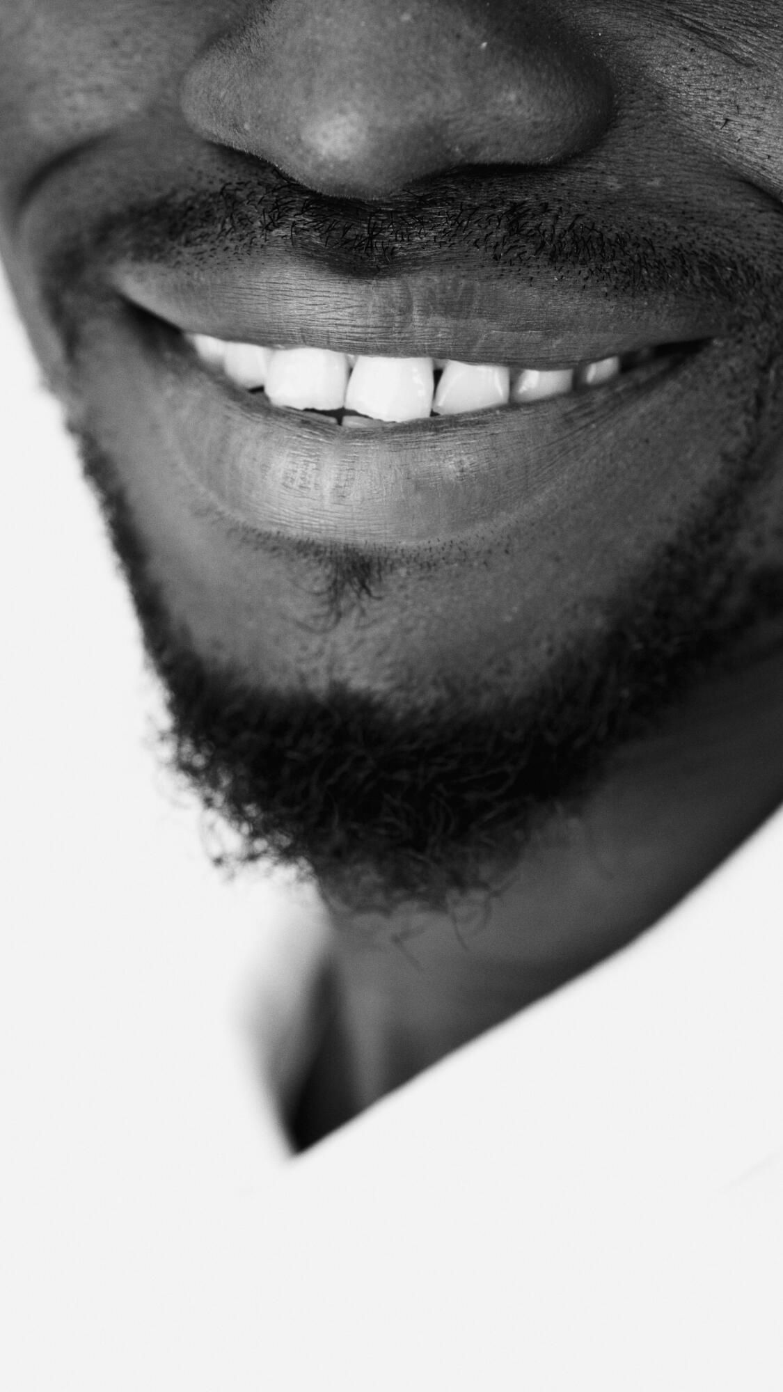 How Chris Rock's teeth changed over the years